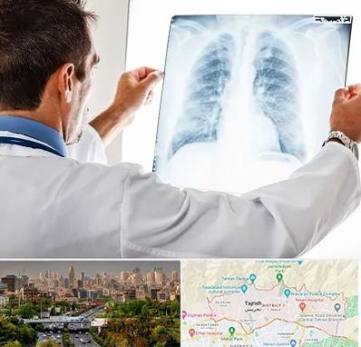 دکتر متخصص ریه در منطقه 1 تهران 