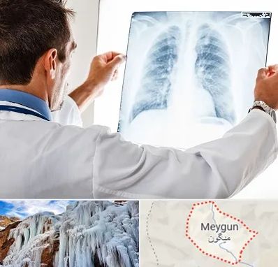 دکتر متخصص ریه در میگون