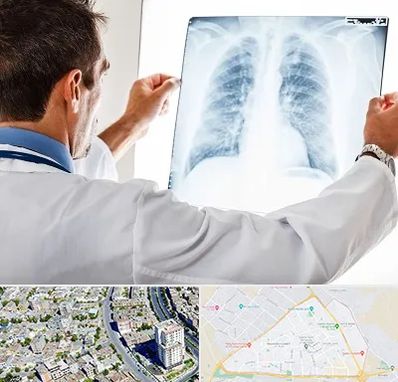 دکتر متخصص ریه در قاسم آباد مشهد