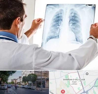 دکتر متخصص ریه در شهرک ولیعصر