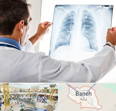 دکتر متخصص ریه در بانه