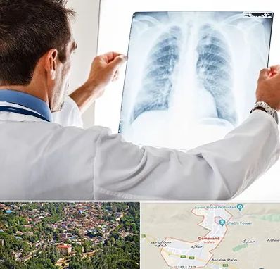 دکتر متخصص ریه در دماوند