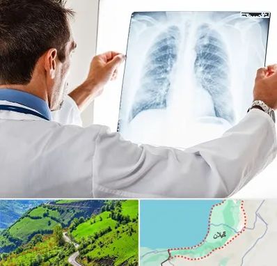 دکتر متخصص ریه در گیلان