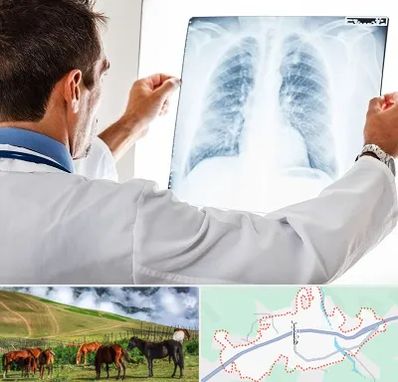 دکتر متخصص ریه در تالش