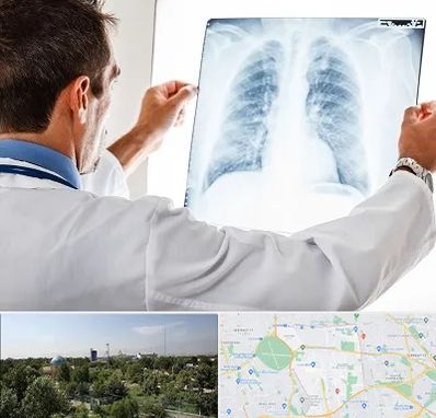 دکتر متخصص ریه در منطقه 16 تهران 