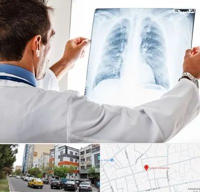 دکتر متخصص ریه در هفده شهریور تبریز