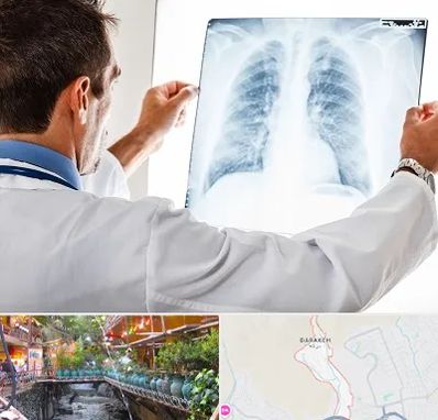 دکتر متخصص ریه در درکه
