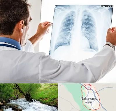 دکتر متخصص ریه در نهاوند
