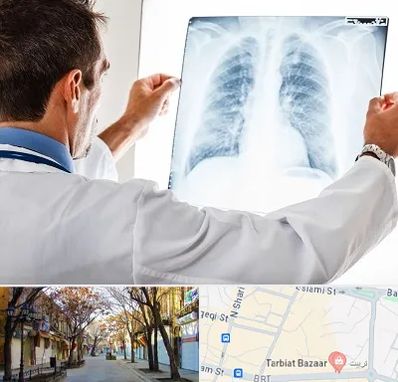 دکتر متخصص ریه در تربیت تبریز