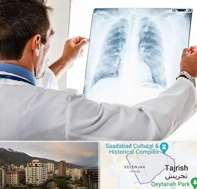 دکتر متخصص ریه در زعفرانیه 