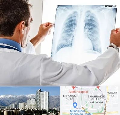 دکتر متخصص ریه در شهرک غرب 