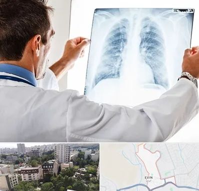 دکتر متخصص ریه در اوین