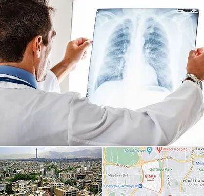 دکتر متخصص ریه در گیشا 