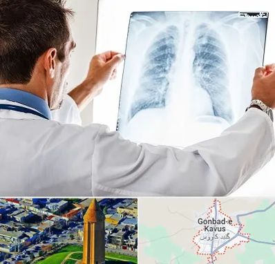 دکتر متخصص ریه در گنبد کاووس