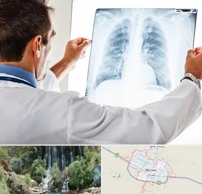دکتر متخصص ریه در شیروان