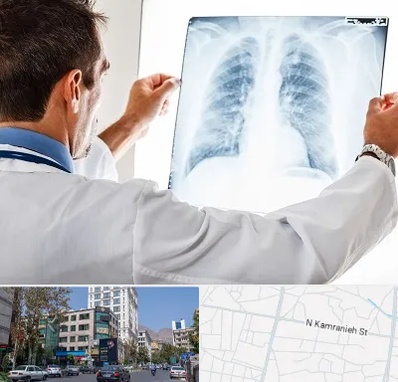 دکتر متخصص ریه در کامرانیه