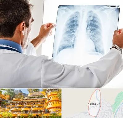 دکتر متخصص ریه در دربند