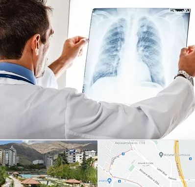 دکتر متخصص ریه در شهر زیبا 