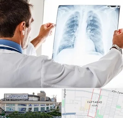 دکتر متخصص ریه در یافت آباد