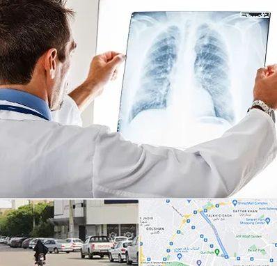 دکتر متخصص ریه در قدوسی شرقی شیراز