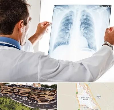 دکتر متخصص ریه در شاهین شهر