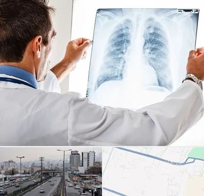 دکتر متخصص ریه در بلوار ارتش