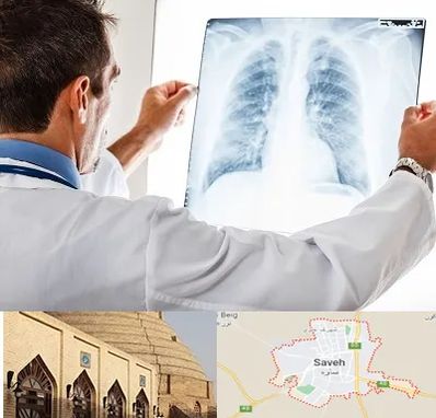 دکتر متخصص ریه در ساوه
