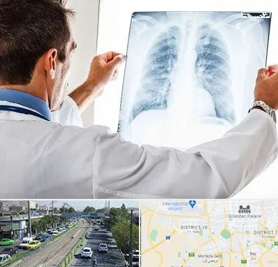 دکتر متخصص ریه در جنوب تهران 