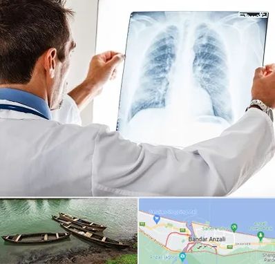 دکتر متخصص ریه در بندر انزلی