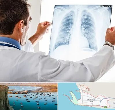 دکتر متخصص ریه در چابهار