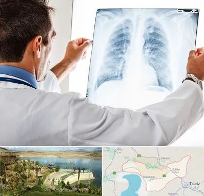 دکتر متخصص ریه در شبستر