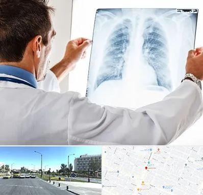 دکتر متخصص ریه در بلوار کلاهدوز مشهد