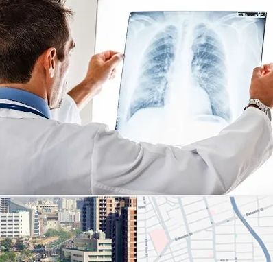 دکتر متخصص ریه در خیابان بهشتی