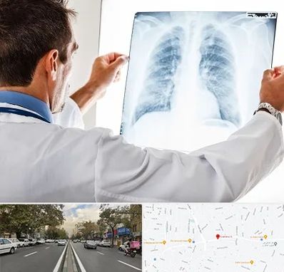 دکتر متخصص ریه در دولت