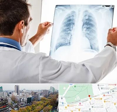 دکتر متخصص ریه در بلوار کشاورز 