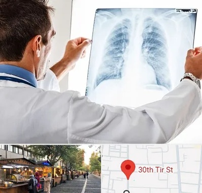 دکتر متخصص ریه در سی تیر