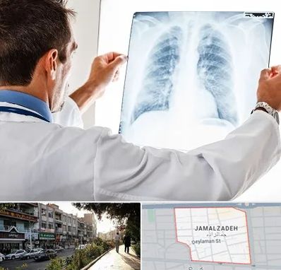 دکتر متخصص ریه در خیابان جمالزاده