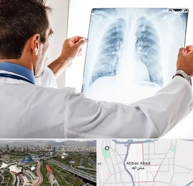 دکتر متخصص ریه در عباس آباد تهران