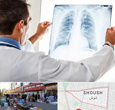دکتر متخصص ریه در شوش