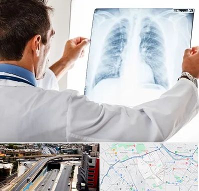 دکتر متخصص ریه در ستارخان شیراز