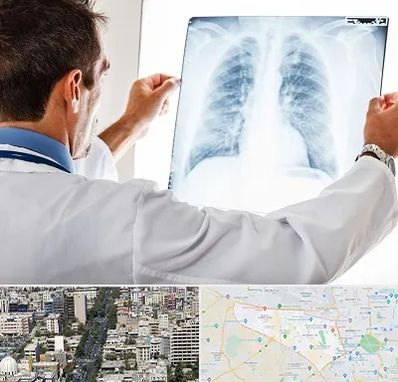 دکتر متخصص ریه در منطقه 18 تهران 