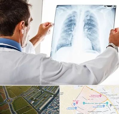 دکتر متخصص ریه در الهیه مشهد