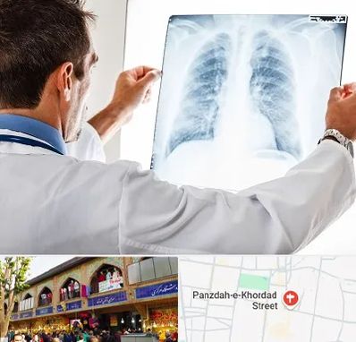دکتر متخصص ریه در 15 خرداد