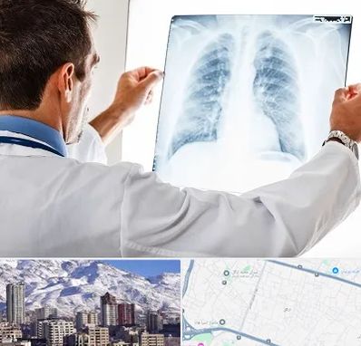 دکتر متخصص ریه در ازگل