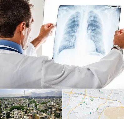 دکتر متخصص ریه در منطقه 8 تهران 