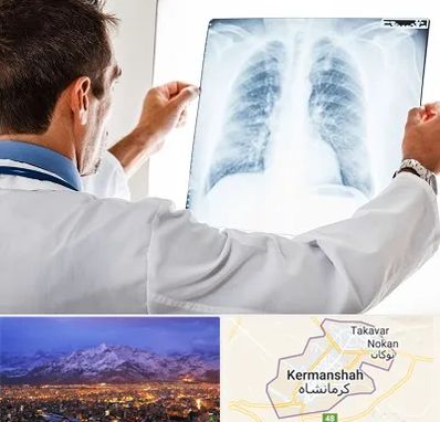 دکتر متخصص ریه در کرمانشاه