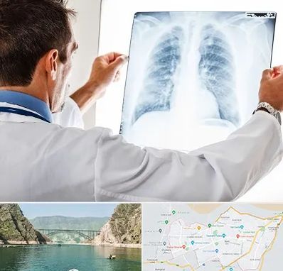 دکتر متخصص ریه در ایلام