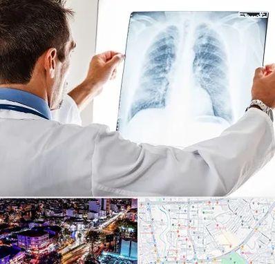 دکتر متخصص ریه در منظریه رشت