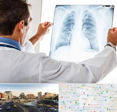 دکتر متخصص ریه در منطقه 7 تهران 