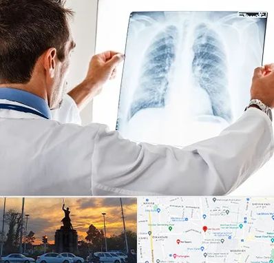 دکتر متخصص ریه در میدان حر 